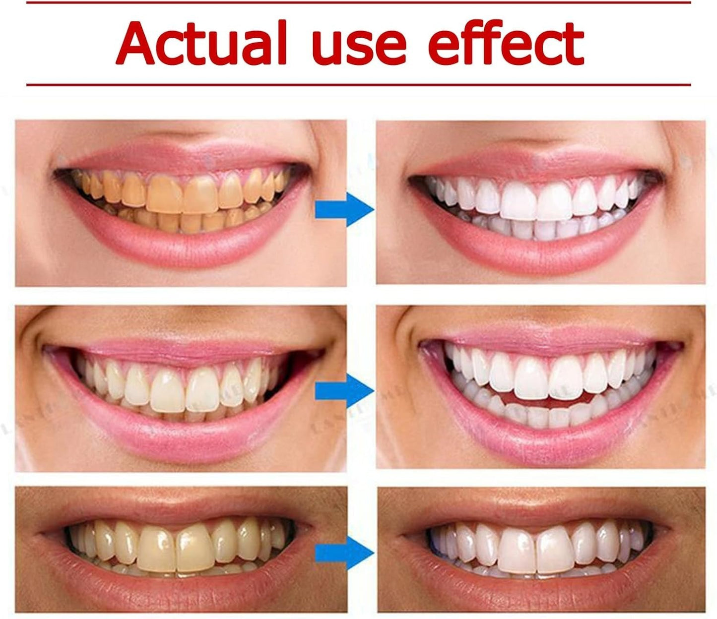 Yayashi SP-4 Ultra Whitening Toothpaste