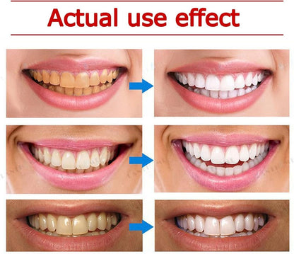 Yayashi SP-4 Ultra Whitening Toothpaste